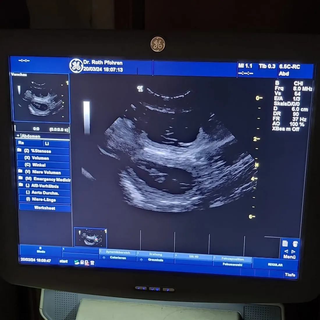 Ultraschallbild von Ailas Welpen auf dem Monitor